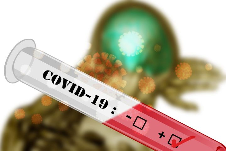 В республике подтверждено 55 новых случаев  COVID-19